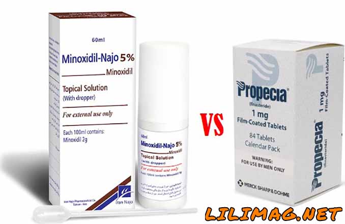 تفاوت ماینوکسیدیل با فیناستراید در درمان ریزش مو چیست؟