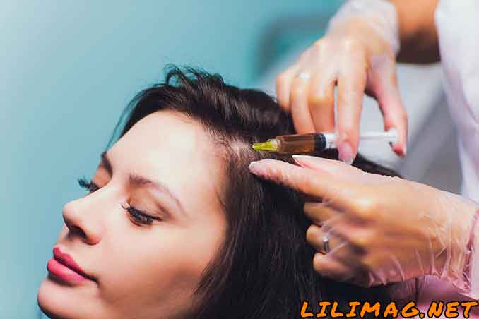 روش كاشت مو در زنان چگونه است؟
